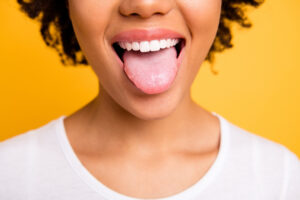 Des remèdes contre la langue blanche